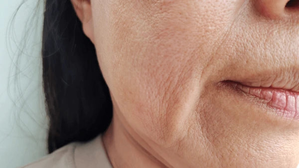 Ageing